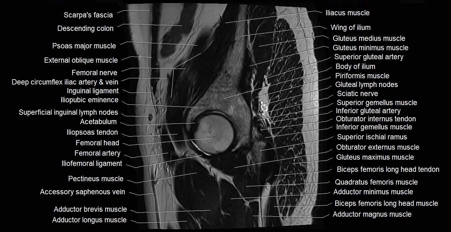 male pelvis sagittal cross sectional anatomy 3T mri image 2.webp